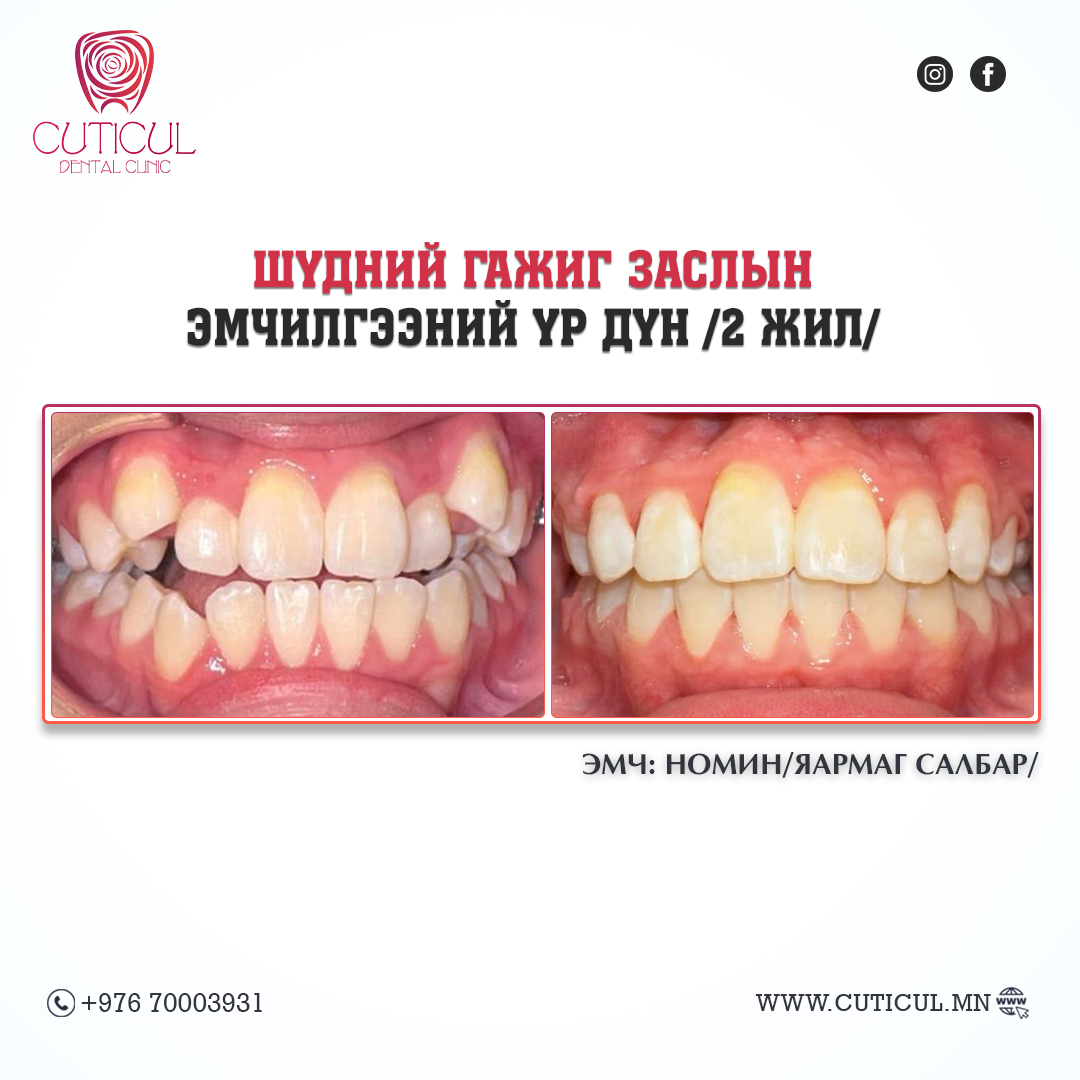 Result Image 5